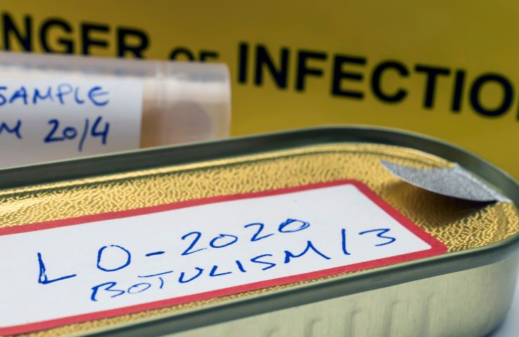 Una diagnosi da botulismo